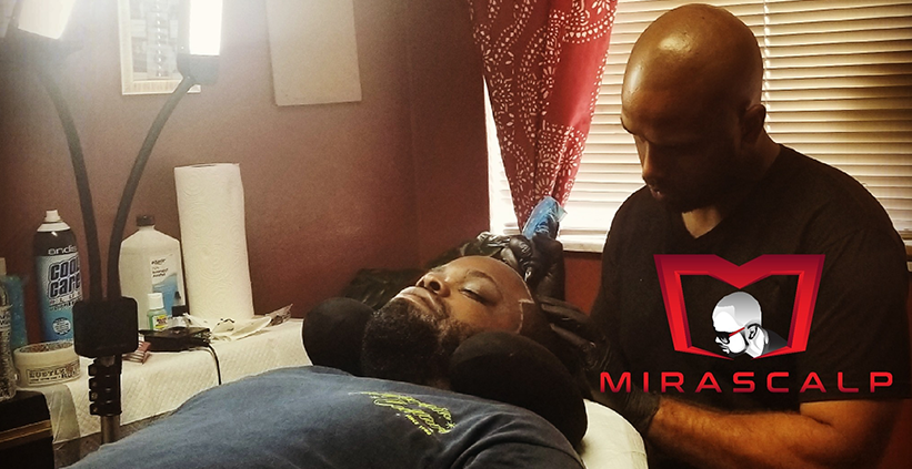 Scalp Micro Pigmentation SMP