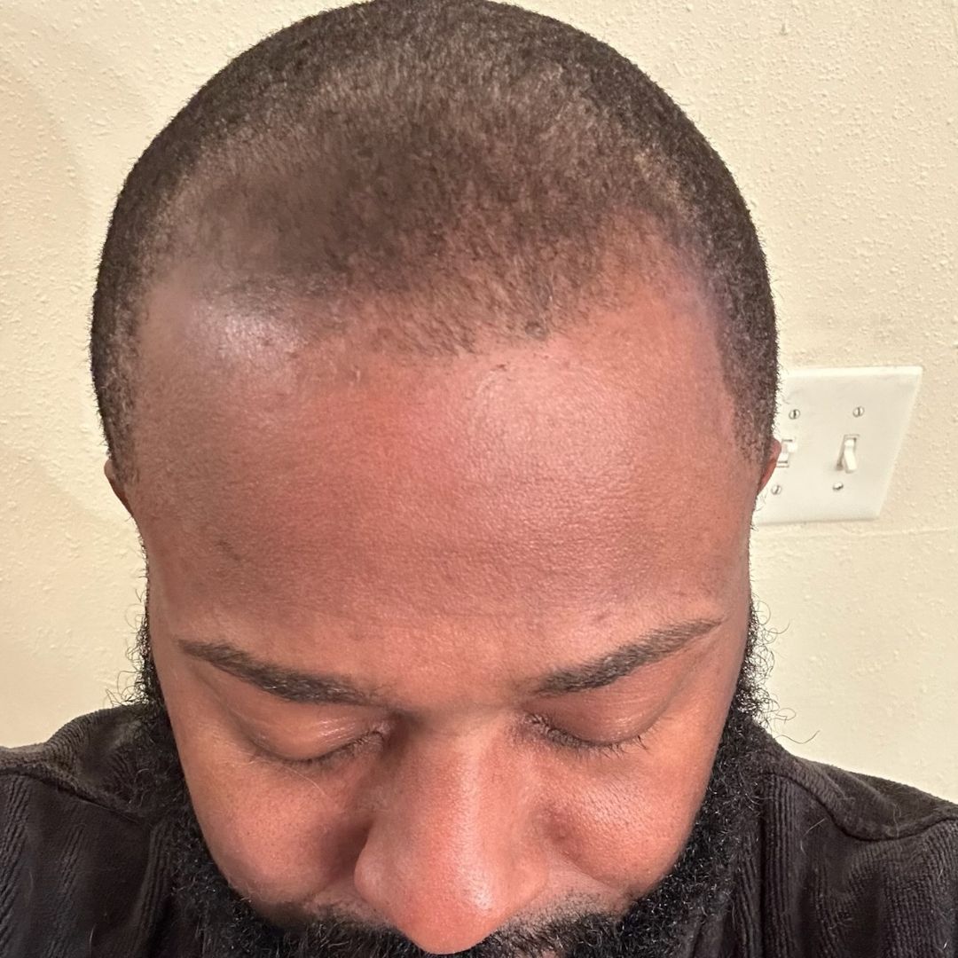 man with perfect hairline